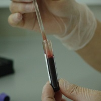 Medical vial being filled with blood from a needle