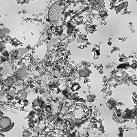 Microscopic image of diatomaceous earth